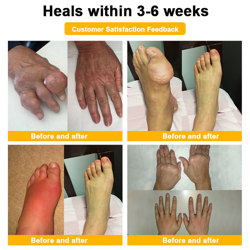 🐝AQA™ Botulinum & Bee Essence Pain-Relief Bone Healing Cream